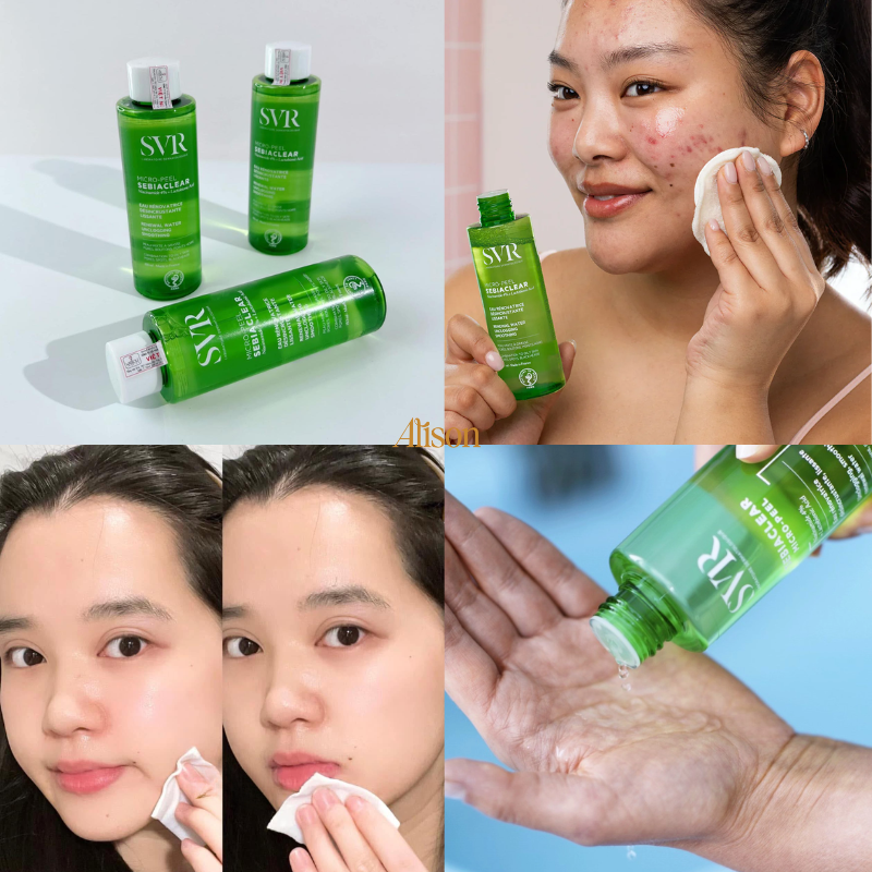Toner Cho Da Dầu Mụn